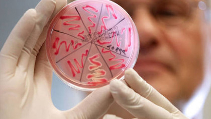 Інформує Лубенський підрозділ ДУ "«Полтавський обласний центр контролю та профілактики хвороб"