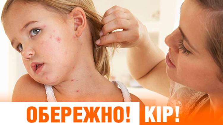 УВАГА! У Пирятинській територіальній громаді  спалах кору!